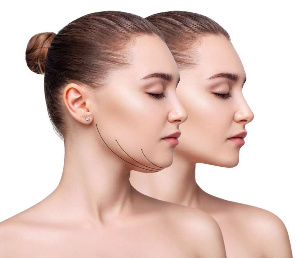 Home Loose Skin Tightening